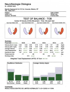 Test of balance, Vértigo y mareo